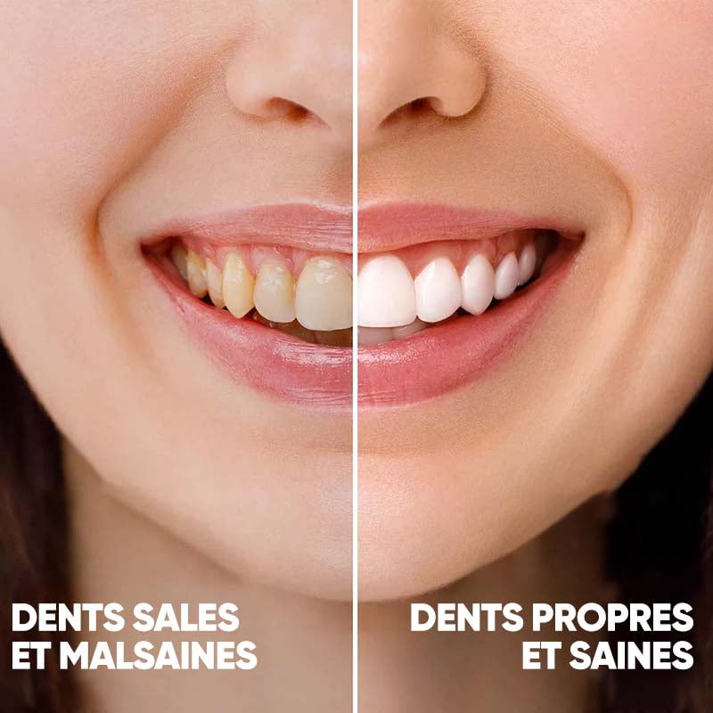 Dentifrice à l'hydroxyapatite