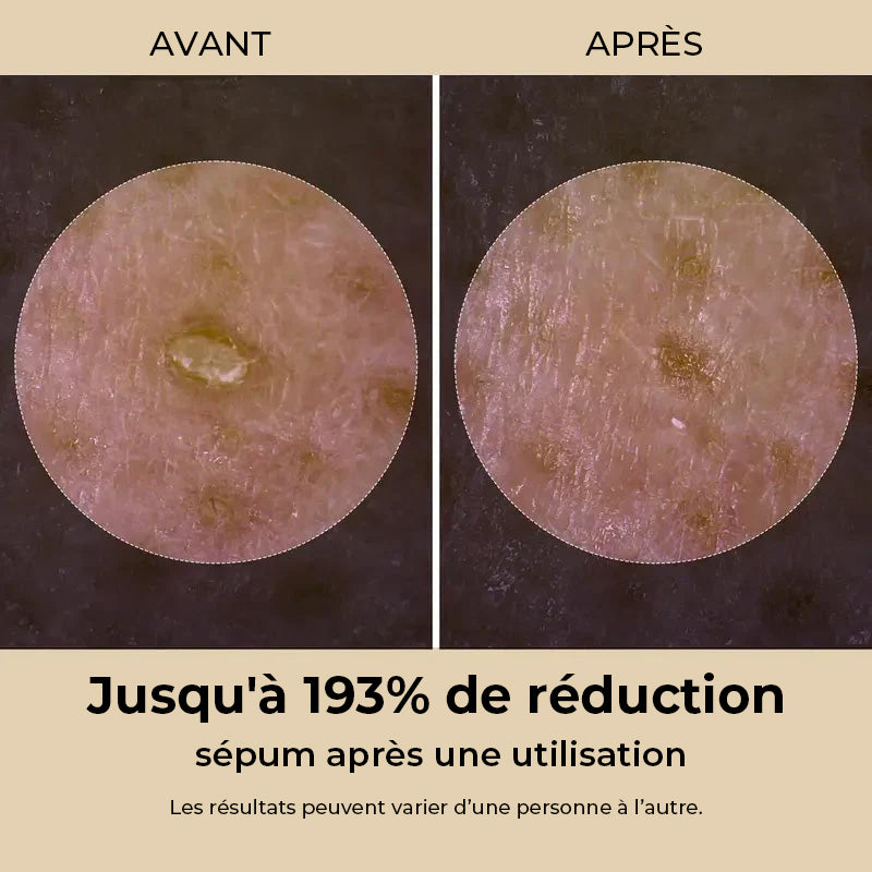 Gentle Exfoliating Ampoule – Black Rice