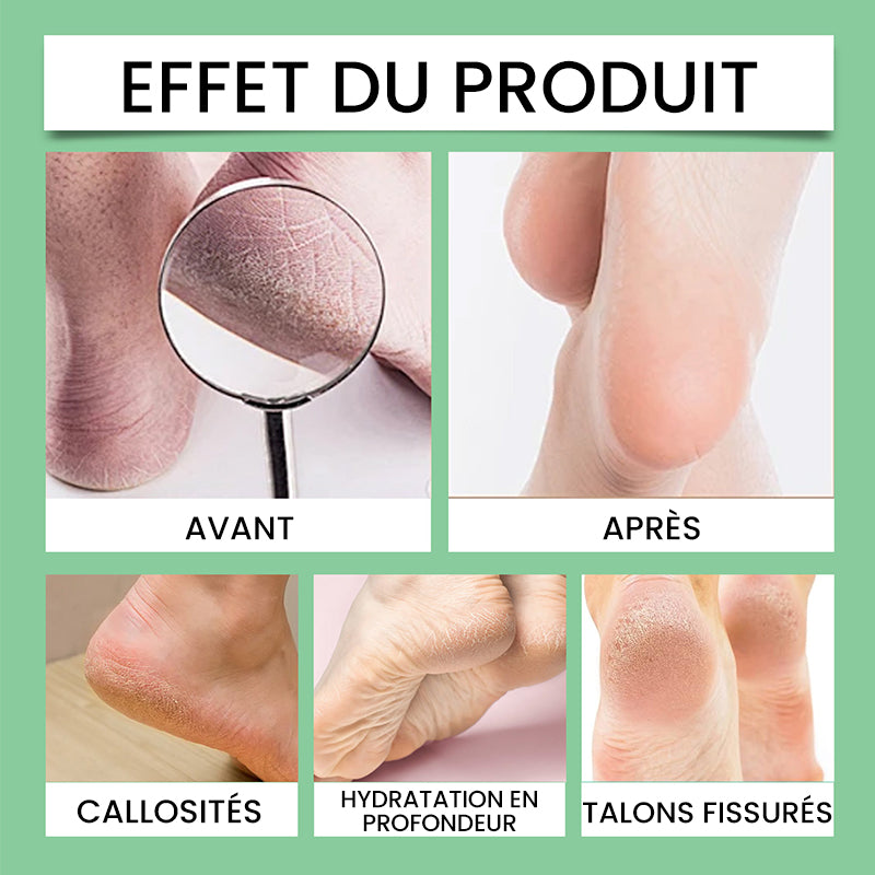 Éliminateur de callosités des pieds