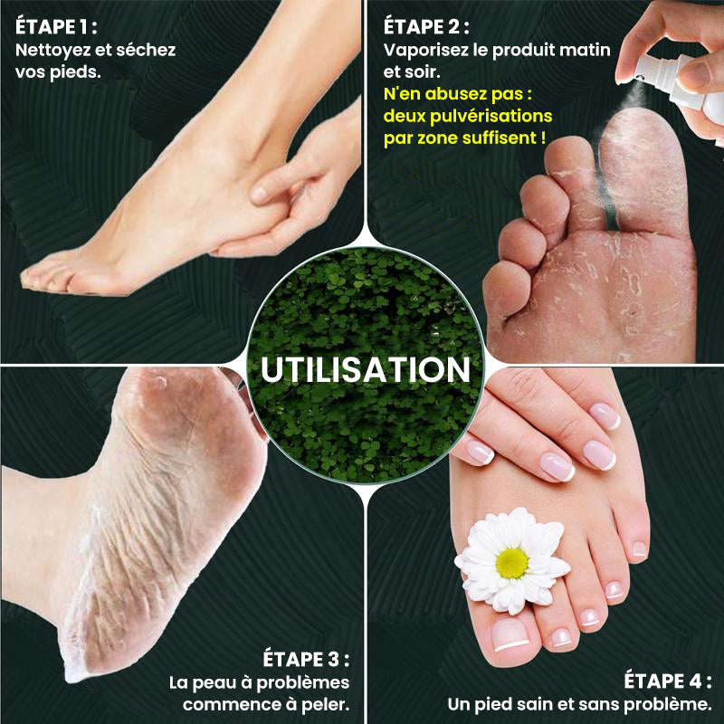 Éliminateur de callosités des pieds