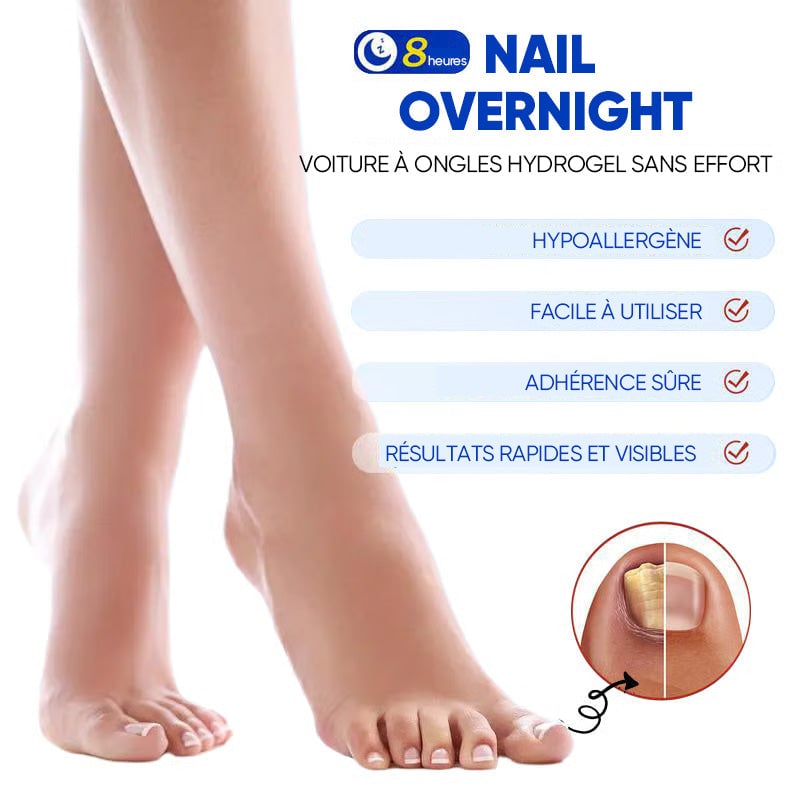 Plaques fongiques sur les ongles