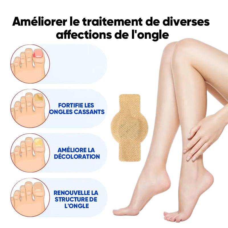 Plaques fongiques sur les ongles