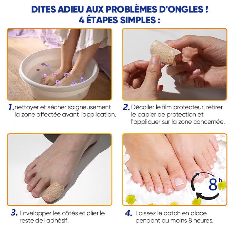 Plaques fongiques sur les ongles