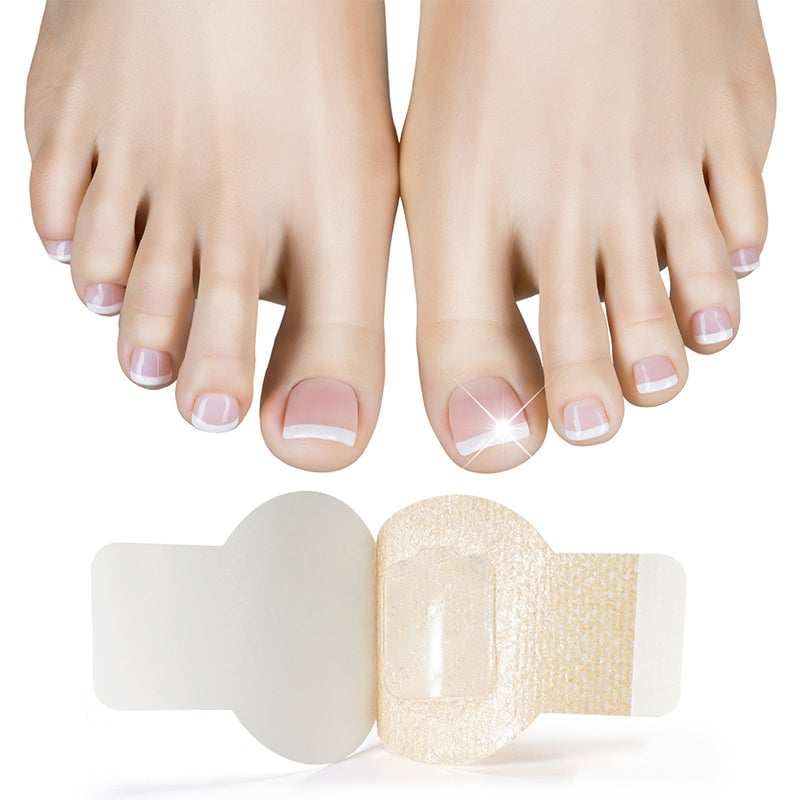 Plaques fongiques sur les ongles