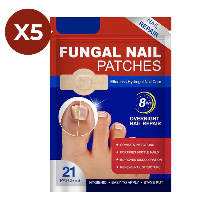 Plaques fongiques sur les ongles